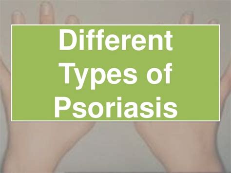 Different Types Of Psoriasis