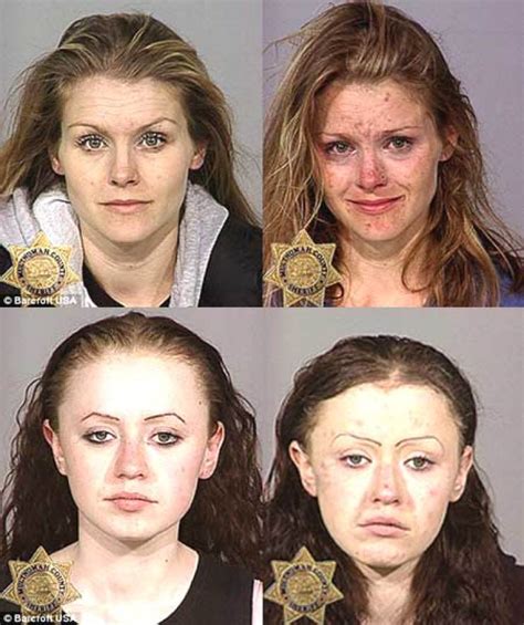 Shocking Before And After Photos Show How Drug Addiction Takes Devastating Toll On Faces Of Users