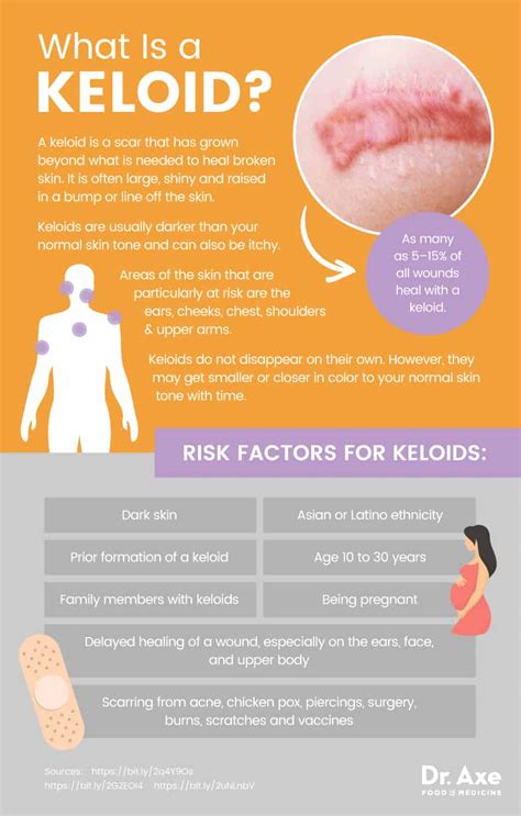 Keloid Causes Plus Natural Tips To Help Treat Keloids Dr Axe