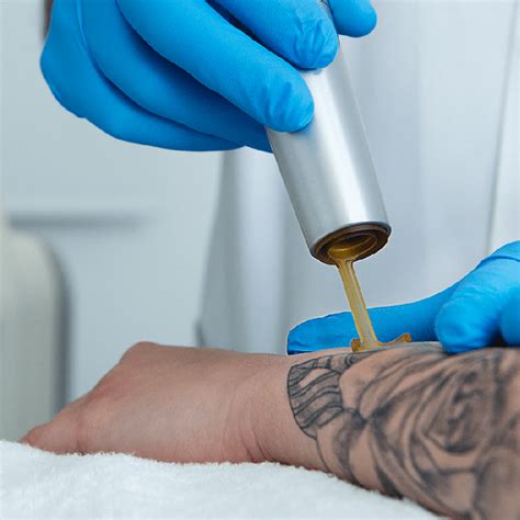 Eliminación de tatuajes con láser Picoway Clinica Tufet Barcelona
