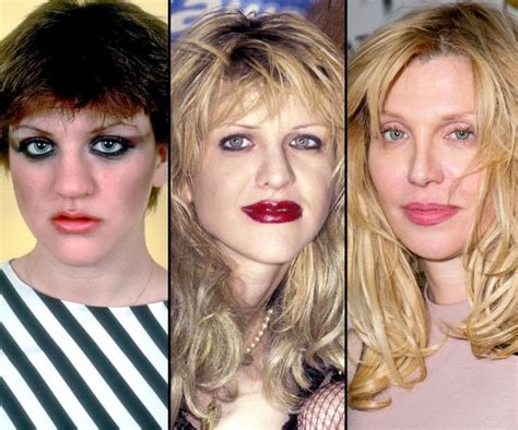 Courtney Love Before And After Plastic Surgery Plastic Surgery