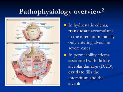 Ppt Pulmonary Edema Pathophysiological Considerations Manifestations