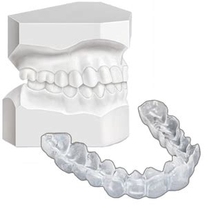 Find the latest alabama classifieds available from al.com online classifieds and affiliated newspaper classifieds. Fixed orthodontic appliances - Specialized dental studio ...