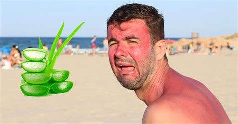 How Long Does Sunburn Last With Aloe A Comprehensive Guide