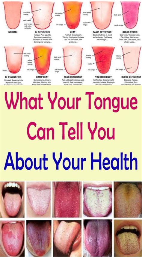 Every Person Have An Unique Tongue With Specific Characteristics That