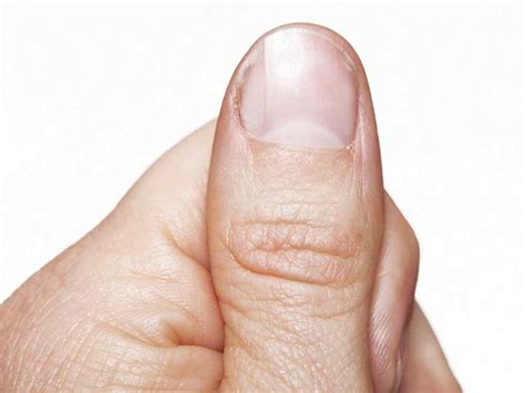 What Causes White Spots Underneath Your Fingernails Design Talk