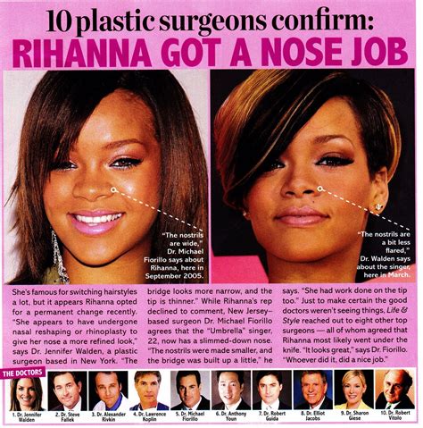 Life And Style Rihanna Rhinoplasty ~ Plastic Surgery