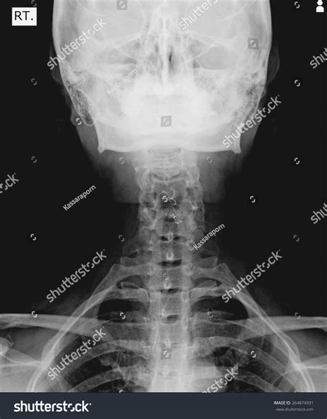 Maybe you would like to learn more about one of these? Edit Images Free Online - X-ray picture | Shutterstock Editor