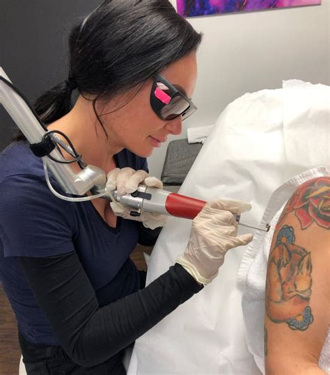 You can offer people services they may be in need of, and help improves someone's if opening a tattoo removal business is something you are passionate about, the starting costs will be worth it in the long run. How to start a tattoo removal business - 🦉 Hoot Blog