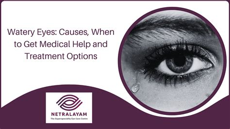 Watery Eyes Causes When To Get Medical Help And Treatment Options