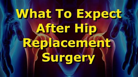 What To Expect After Hip Replacement Surgery Youtube