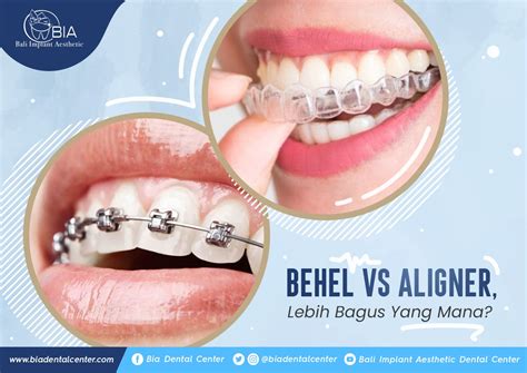 Metal Braces Bali Implant Aesthetic Bia Dental Center