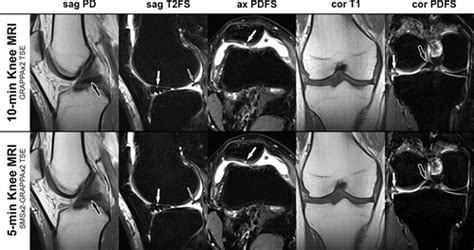 Five Minute Five Sequence Knee Mri Using Combined Simultaneous