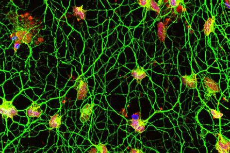 Human Skin Cells Transformed Into Motor Neurons Neuroscience News