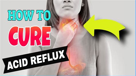 💥 How To Cure Acid Reflux Naturally Fast 👉 9 Methods Youtube