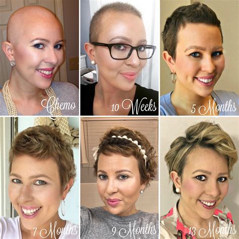 Post Chemo Hair Growth Styling Tips Hair Growth Stages Hair Growth
