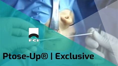 Ptose Up Eptfe Frontalis Suspension Features Procedure