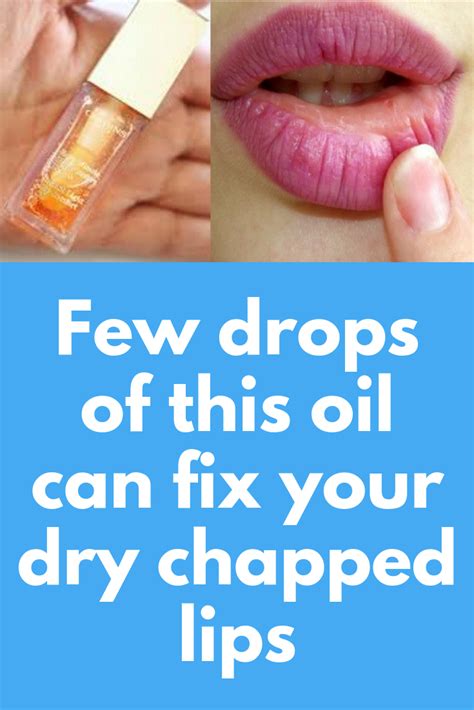 Few Drops Of This Oil Can Fix Your Dry Chapped Lips This Article