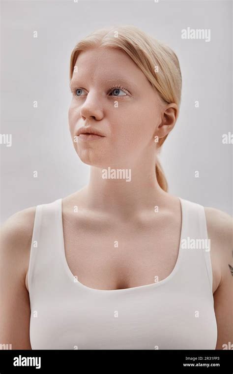 Minimal Portrait Of Ethereal Blonde Girl With Albinism Posing Against White Background Stock