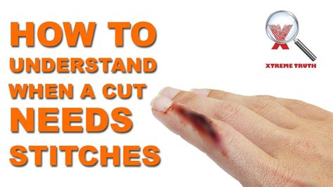 How To Understand When A Cut Needs Stitches Xtreme Truth First Aid