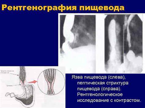 Дополнительные методы исследования органов пищеварения и почек Ткачёв Картинка - Дополнительные методы исследования органов пищеварения и почек Ткачёв