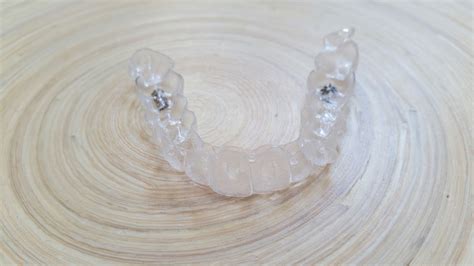 Was muss selbst bezahlt werden? Zahnspange mit 23: Meine Erfahrungen mit Invisalign