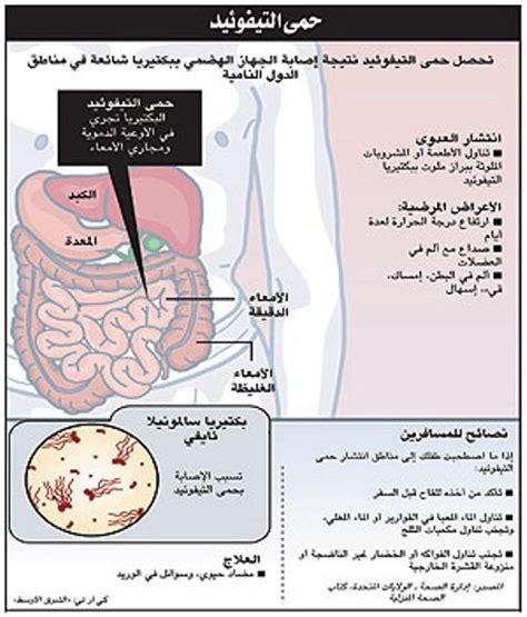 سيشكل العلاج اللاحق للطبيب في طبيعة المضادات الحيوية اختبارًا للافتراض. ...واختلطت النفايات مع مياه الأمطار: التيفوئيد في دياركم ...