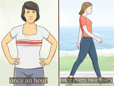 Bunions (medical name is hallux valgus) develop as a. 3 Ways to Exercise to Prevent Blood Clots - wikiHow