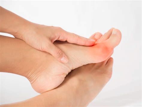 Big Toe Arthritis Symptoms — River Podiatry I The Best Foot And Ankle Care In Nynj