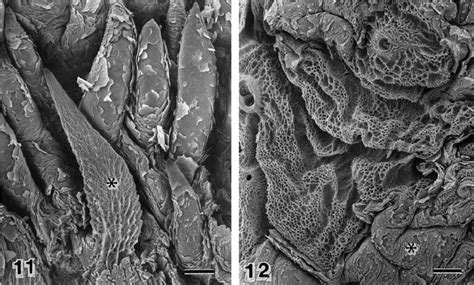Sem Figure Of Several Long Conical Papillae Derived From The