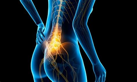 Chiropractor For Sciatica Nerve Pain Were Rated 55