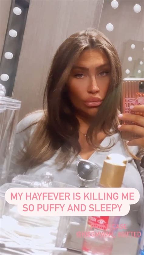 Pregnant Lauren Goodger Worries She Looks Puffy As She Battles Severe Hayfever Irish Mirror