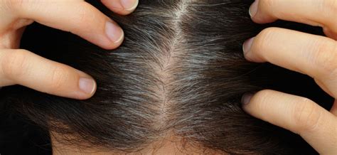 How To Restore Damaged Hair Follicles Viviscal Healthy Hair Tips
