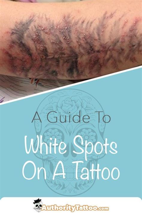 Getting White Spots And Bumps On Your Tattoo Can Be Very Concerning We