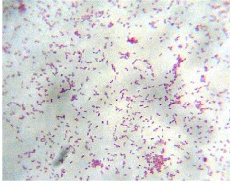 Gram Stained Smear Of Blood Culture Broth Showing Pleomorphic