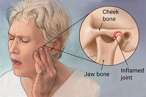 Jamss Professional Solutions For Jaw Pain And Strain