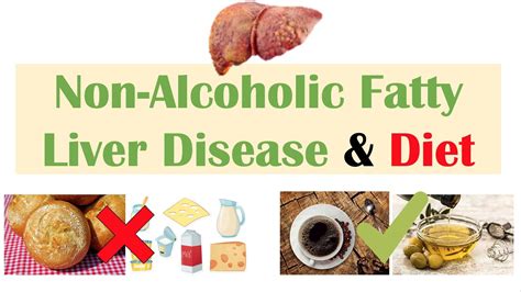 Non Alcoholic Fatty Liver Disease And Diet Diets To Prevent And Reduce