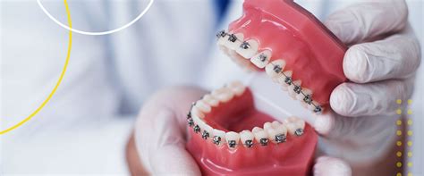Traditional Braces Vs Invisalign How To Choose Smile Fort Worth