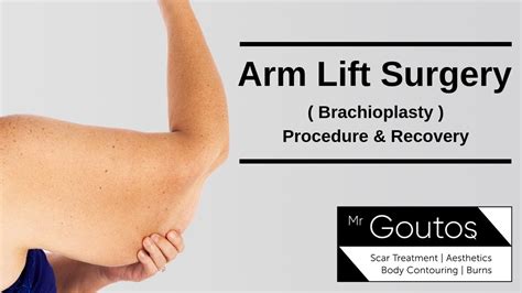 Brachioplasty Arm Lift Surgery Procedure And Recovery Youtube
