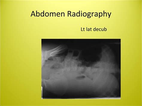 Abdomen Radiography Ppt Daniel Jp Radiology Technologist