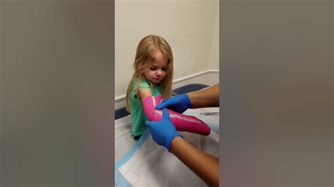 Kinsley Getting Her Cast Off Youtube