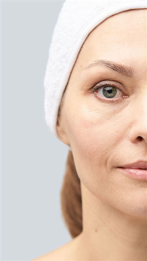 Anti Ageing Eye Treatments Laser And Skin Clinics