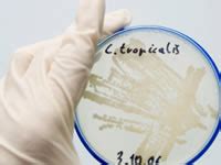 Check spelling or type a new query. my mess/ms: The diabetes and Thrush