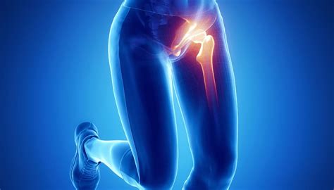 Groin Pain And When To Call A Doctor Physio Soton