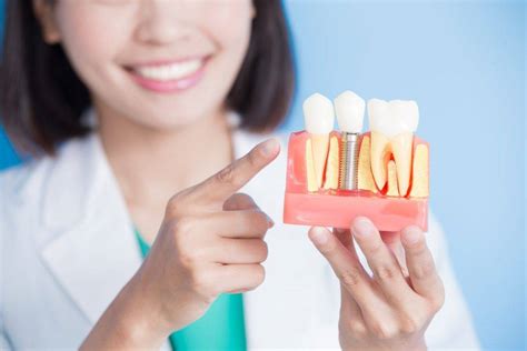How Long Do Dental Implants Last Parkview Dentistry Of Az