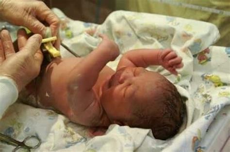 Delayed Cord Clamping Why You Should Demand It