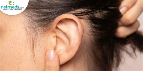Ear Cancer Causes Symptoms And Treatment