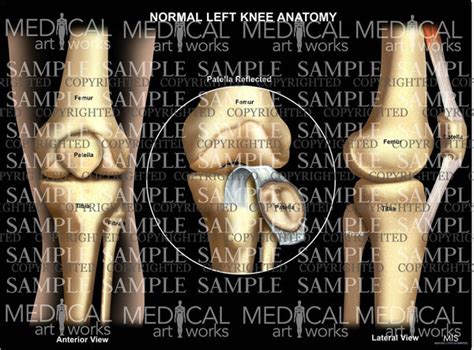 Normal Left Knee Anatomy 6 — Medical Art Works
