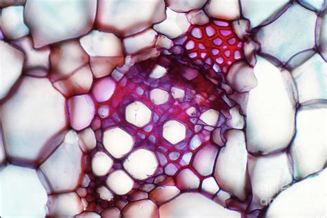Plant Vascular Tissue Photograph By Choksawatdikorn Science Photo