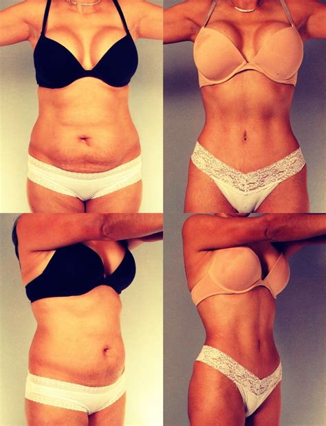 How To Lose Inches Of Your Tummy Overnight Diy Body Wrap For Cheap Diy Body Wrap Body